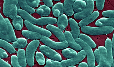 6 Florida counties saw 'unusual increase' in flesh-eating bacteria after hurricanes: health officials